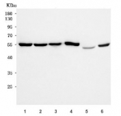 Western blot testing of 1) human HepG2, 2) human HeLa, 3) human Jurkat, 4) human MCF7, 5) mouse brain and 6) mouse lung tissue lysate with WRS antibody. Predicted molecular weight ~53 kDa.