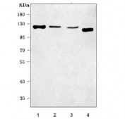 Western blot testing of 1) human HeLa, 2) human placenta, 3) mouse testis and 4) mouse NIH 3T3 cell lysate with RAI14 antibody. Predicted molecular weight ~110 kDa.
