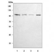 Western blot testing of human 1) HeLa, 2) A549, 3) COLO-320 and 4) A431 cell lysate with CD106 antibody. Expected molecular weight: 74-80 kDa (unmodified), 100-110 kDa (glycosylated).