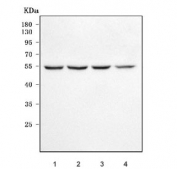 Western blot testing of human 1) HeLa, 2) HepG2, 3) K562 and 4) PC-3 cell lysate with RNA exonuclease 4 antibody. Predicted molecular weight ~47 kDa.