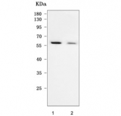 Western blot testing of human 1) 293T and 2) HeLa cell lysate with TAB1 antibody. Predicted molecular weight ~55 kDa.