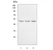 Western blot testing of human 1) HepG2, 2) HeLa and 3) human placental tissue lysate with GCM1 antibody. Predicted molecular weight ~49 kDa.