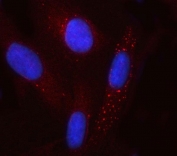 Immunofluorescent staining of FFPE human U-2 OS cells with GCM1 antibody (red) and DAPI nuclear stain (blue). HIER: steam section in pH6 citrate buffer for 20 min.
