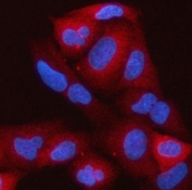Immunofluorescent staining of FFPE human A549 cells with RAP1GAP antibody (red) and DAPI nuclear stain (blue). HIER: steam section in pH6 citrate buffer for 20 min.