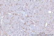 IHC staining of FFPE mouse brain tissue with RAP1GAP antibody. HIER: boil tissue sections in pH8 EDTA for 20 min and allow to cool before testing.