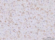 IHC staining of FFPE rat brain tissue with RAP1GAP antibody. HIER: boil tissue sections in pH8 EDTA for 20 min and allow to cool before testing.
