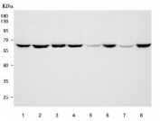 Western blot testing of 1) human Jurkat, 2) human HeLa, 3) human K562, 4) human MCF7, 5) rat testis, 6) rat liver, 7) mouse testis and 8) mouse liver tissue lysat with ASNS antibody. Predicted molecular weight ~64 kDa.