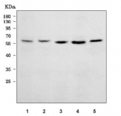 Western blot testing of 1) human Daudi, 2) human Jurkat, 3) human SH-SY5Y, 4) rat brain and 5) mouse brain tissue lysate with Syntrophin gamma 2 antibody. Predicted molecular weight ~60 kDa.