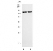 Western blot testing of human 1) K562 and 2) 293T cell lysate with TTLL12 antibody. Predicted molecular weight ~74 kDa.