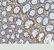 Immunohistochemical staining of FFPE human colon tissue with SGSH antibody, HRP-secondary and DAB substrate. HIER: boil tissue sections in pH8 EDTA for 20 min and allow to cool before testing.