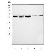 Western blot testing of 1) human 293T, 2) human HepG2, 3) human MCF7, 4) rat lung and 5) mouse lung lysate with SGSH antibody. Predicted molecular weight ~56 kDa but may be observed at higher molecular weights due to glycosylation.