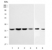Western blot testing of 1) human HepG2, 2) human MOLT4, 3) human K562, 4) human HeLa, 5) rat liver and 6) mouse liver tissue lysate with SGTA antibody. Predicted molecular weight ~34 kDa.
