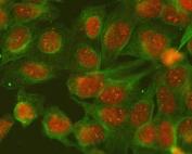 Immunofluorescent staining of FFPE human U-2 OS cells with SGTA antibody (red) and Alpha Tubulin antibody (green). HIER: steam section in pH6 citrate buffer for 20 min.