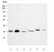 Western blot testing of 1) human A375, 2) human SH-SY5Y, 3) human Jurkat, 4) human MOLT4, 5) mouse ovary and 6) mouse testis tissue lysate with RPAIN antibody. Predicted molecular weight: 16-26 kDa (multiple isoforms), but can be observed at 30-40 kDa.