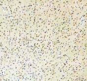 IHC staining of FFPE rat brain tissue with RBM25 antibody. HIER: boil tissue sections in pH8 EDTA for 20 min and allow to cool before testing.