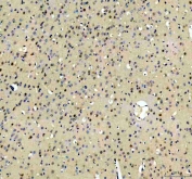 IHC staining of FFPE mouse brain tissue with RBM25 antibody. HIER: boil tissue sections in pH8 EDTA for 20 min and allow to cool before testing.
