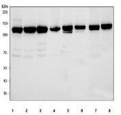 Western blot testing of 1) human PC-3, 2) human SiHa, 3) human A431, 4) human U-2 OS, 5) rat RH35, 6) rat PC-12, 7) mouse NIH 3T3 and 8) mouse RAW264.7 cell lysate with RBM25 antibody. Predicted molecular weight ~100 kDa but commonly observed at ~120 kDa.