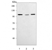Western blot testing of 1) human 293T, 2) human A549 and 3) mouse SP2/0 cell lysate with UHRF1 antibody. Predicted molecular weight ~91 kDa, commonly observed at 91-106 kDa.