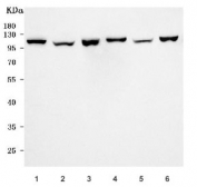 Western blot testing of 1) rat spleen, 2) mouse spleen, 3) rat C6, 4) rat brain, 5) mouse brain and 6) mouse NIH 3T3 cell lysate with Cd39 antibody. Expected molecular weight: 34-100 kDa depending on isoform and level of glycosylation.