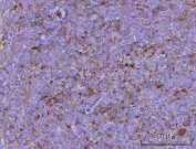 IHC staining of FFPE rat spleen tissue with Cd39 antibody. HIER: boil tissue sections in pH8 EDTA for 20 min and allow to cool before testing.
