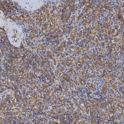 IHC staining of FFPE human spleen tissue with SHQ1 antibody. HIER: boil tissue sections in pH8 EDTA for 20 min and allow to cool before testing.