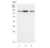 Western blot testing of human 1) A549, 2) 293T and 3) MOLT4 cell lysate with SHQ1 antibody. Predicted molecular weight ~65 kDa, observed here at 70-80 kDa.