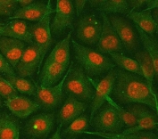 Immunofluorescent staining of FFPE human PC-3 cells with GNB1 antibody (red) and Alpha Tubulin mAb (green). HIER: steam section in pH6 citrate buffer for 20 min.