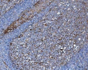 IHC staining of FFPE human tonsil tissue with B7-H3 antibody. HIER: boil tissue sections in pH8 EDTA for 20 min and allow to cool before testing.