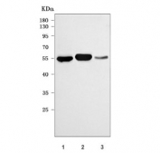 Western blot testing of 1) human MOLT4, 2) mouse thymus and 3) mouse spleen tissue lysate with RAG2 antibody. Predicted molecular weight ~59 kDa.