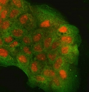 Immunofluorescent staining of FFPE human A431 cells with Regulator of G-protein signaling 9 antibody (red) and Beta Tubulin mAb (green). HIER: steam section in pH6 citrate buffer for 20 min.