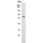 Western blot testing of human HeLa cell lysate with CYP27B1 antibody. Predicted molecular weight ~57 kDa.