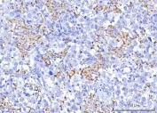 IHC staining of FFPE human testicular seminoma tissue with PTPIP51 antibody. HIER: boil tissue sections in pH8 EDTA for 20 min and allow to cool before testing.