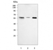 Western blot testing of human 1) HaCaT, 2) Caco-2 and 3) K562 cell lysate with PTPIP51 antibody. Predicted molecular weight ~52 kDa.