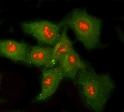 Immunofluorescent staining of FFPE human A549 cells with Ribonuclease H1 antibody (red) and Beta Tubulin antibody (green). HIER: steam section in pH6 citrate buffer for 20 min.
