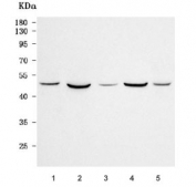 Western blot testing of 1) human HEL, 2) rat brain, 3) mouse testis, 4) mouse brain and 5) mouse NIH 3T3 cell lysate with RBMY1A1 antibody. Predicted molecular weight ~56/51/41 kDa (three isoforms).