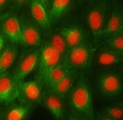 Immunofluorescent staining of FFPE human HeLa cells with RBMY1A1 antibody (red) and Beta Tubulin mAb (green). HIER: steam section in pH6 citrate buffer for 20 min.