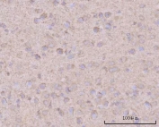 IHC staining of FFPE rat brain tissue with HBBM antibody. HIER: boil tissue sections in pH8 EDTA for 20 min and allow to cool before testing.
