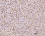 IHC staining of FFPE mouse brain tissue with HBBM antibody. HIER: boil tissue sections in pH8 EDTA for 20 min and allow to cool before testing.