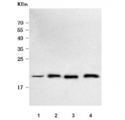 Western blot testing of 1) huma U-251, 2) rat brain, 3) rat C6 and 4) mouse brain tissue lysate with HBBM antibody. Predicted molecular weight ~19 kDa.