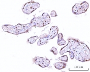 IHC staining of FFPE human placental tissue with mRNA-capping enzyme antibody. HIER: boil tissue sections in pH8 EDTA for 20 min and allow to cool before testing.