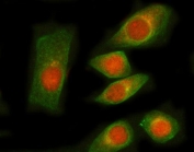 Immunofluorescent staining of FFPE human SiHa cells with mRNA-capping enzyme antibody (red) and Beta Tubulin mAb (green). HIER: steam section in pH6 citrate buffer for 20 min.