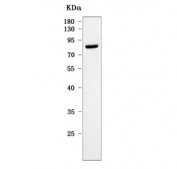 Western blot testing of human placental tissue lysate with Ras and Rab interactor 1 antibody. Predicted molecular weight ~84 kDa.