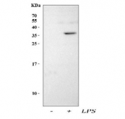 Western blot testing of lysate from LPS-treated and untreated mouse RAW264.7 cells using Interleukin-1 beta antibody. Predicted molecular weight ~31 kDa (precursor) and ~17 kDa (mature).