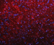 Immunofluorescent staining of FFPE mouse brain tissue with RIMS-binding protein 2 antibody (red) and DAPI nuclear stain (blue). HIER: steam section in pH8 EDTA buffer for 20 min.