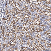 IHC staining of FFPE human spleen tissue with TP53I13 antibody. HIER: boil tissue sections in pH8 EDTA for 20 min and allow to cool before testing.