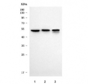 Western blot testing of 1) human HaCaT, 2) mouse heart and 3) rat heart tissue lysate with TP53I13 antibody. Predicted molecular weight ~42 kDa.