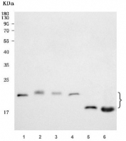 Western blot testing of 1) human SH-SY5Y, 2) human SK-N-SH, 3) U-87 MG, 4) U-251, 5) rat brain and 6) mouse brain tissue lysate with RIT2 antibody. Predicted molecular weight: 17-25 kDa (multiple isoforms).