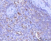 IHC staining of FFPE human spleen tissue with ITGA2B antibody. HIER: boil tissue sections in pH8 EDTA for 20 min and allow to cool before testing.