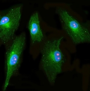 Immunofluorescent staining of FFPE human U-87 MG cells with NPP1 antibody (red), Beta Tubulin mAb (green) and DAPI nuclear stain (blue). HIER: steam section in pH6 citrate buffer for 20 min.