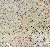 Immunohistochemistry analysis of ROCK1 expression in mouse brain tissue. Paraffin-embedded mouse brain tissue sections were subjected to heat-mediated antigen retrieval in EDTA buffer (pH 8.0) and incubated with anti-ROCK1 antibody, followed by HRP-conjugated secondary antibody and DAB chromogen development. ROCK1 immunoreactivity is detected in neural cells and surrounding neuropil, with hematoxylin nuclear counterstain (blue).